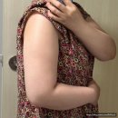 김포 구래동 피부과 온다리프팅 받고 온 솔직후기 (팔뚝, 부유방)
