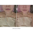 영스뷰티 - 평택시 | 평택뷰티샵 영스뷰티 생체전류 에너지테라피 후기