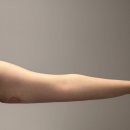 디디동물병원 | 컷주사 원조, 유라인 지방분해주사 팔뚝컷주사 2회차 솔직 후기! 인바디 충격 지표 변화