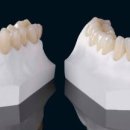 다이아몬드치과기공소 이미지