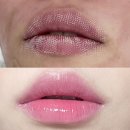 둔산북로 | 둔산동피부관리 라헨느뷰티 트라이엄 입술레이저 후기
