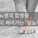 당뇨병의 합병증 발이 썩어가는 '당뇨족' 이미지