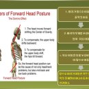 바른자세체형교정원 이미지
