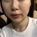 방학동 피부관리샵 화이트스킨케어 수분보습관리 후기