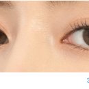 명일안경 이미지