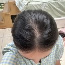메이 리안 | 핑크에이지 탑커버 정수리 가발 3종 비교 후기! 메이·다인·리안 직접 비교해봤어요! (인모100%)