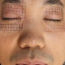 이준영피부과 이미지
