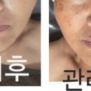 오늘은밝은피부 이미지
