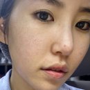 건성 피부 페이스 오일, 함송영거댄 퍼스트 에센스 오일, 피부 장벽 회복