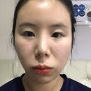 경희바른선한의원 | 여의도한의원 경희바른선한의원 전신교정 치료후기 여의도 한의원