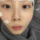 홍대 피부과 전문의 여드름 케어 실제 만족 후기