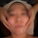 르브아뷰티 | 💆🏻‍♀️오리역피부샵 르브아뷰티 — 단 1회로 물광피부 완성한 애씨큘 시술 후기