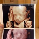 시온DIGITAL | [임신 28주] 시온 여성 병원 3D 입체 초음파 후기 동탄 제일 입체 초음파 금액 비교