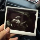 이플랜치과의원 | 임신 20주 차 | 대연동 뉴플랜여성의원 산부인과 방문 후기 (+ 임신성 두통)