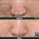 바이더퀄리티 공구_ 엑소 15698 엑소좀 줄기세포앰플로 여드름완화 리프팅케어 추천