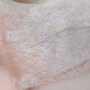 네오메디칼약국 | 압구정 라움성형외과 오타모반..1차후기/처방약/연고 바르는 중