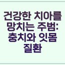 구의고운미치과의원 | 충치 예방하는 도움되는칫솔질