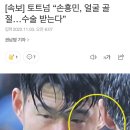 [속보] 토트넘 “손흥민, 얼굴 골절…수술 받는다” 이미지