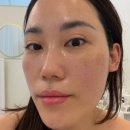다솜 | 일산피부관리 백석 근처 추천 물광필 다솜에스테틱 후기