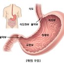 위선종(Gastric adenoma) 이미지