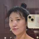 안산 중앙동 피부관리 “황후” :: 여드름피부 골드테라피 후기