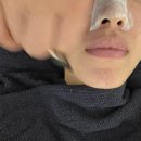 홍산빌딩 | 전주 여드름 관리 차올라메디스킨, 자극 없는 압출로 꿀피부 된 솔직후기