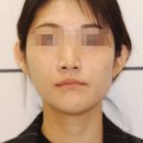 드림라인치과교정과치과의원 | 강남 미소드림치과 얼굴비대칭 교정 비용