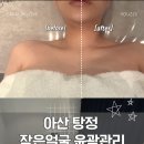 (주)마니커 천안지점 | 탕정 에스테틱 쁘띠팰리스 윤곽관리 후기 천안 피부관리