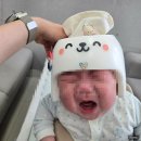 지오프라자(2) | 부산 지오헬멧 사두 단두 두상교정 상담 및 헬멧 피팅 후기