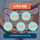 종류도 쓸데없이 존나 많은 과민성 대장 증후군 이미지