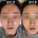 하빌뷰티 | 순천 에스테틱 왕지동 피부관리 하빌뷰티 솔직후기