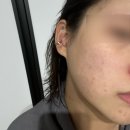 따끈따끈 라운드랩 신상 '자작나무 수분 드롭 세럼' 실사용 솔직 후기 이미지