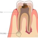 와이플란트치과 네이버블로그