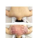 파리바게뜨서면삼정점 | 부산 웨딩관리 더유에스테틱에서 웨딩촬영 전 승모근 관리 받은 후기