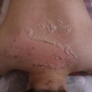 로즈메디칼 이미지