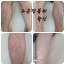 고은정헤어라인