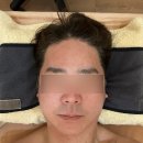 더뷰티순 | 김포 구래동 피부관리 더엘뷰티 스피큘 필링 후기｜남자 피부관리 만족해서 회원권까지 진행한 이유