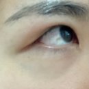 유망안과의원 이미지