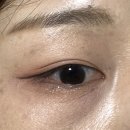 아이젠트리 동호점 | 각산역 안경·렌즈 고민 끝, ‘아이젠트리 위드렌즈 대구동호점’에서 고른 젤리빔