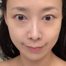 가락동피부관리 피부열내려주는 수화강테라피 쁘에르에스틱