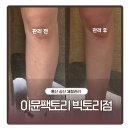 삼산 뷰티샵 이뮨팩토리 빅토리점 누워서 하는 운동, 체형관리