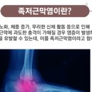 운동화이야기 | 족저근막염 운동화 내돈내산 추천하는 이유 (실사용 후기)