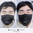 대구 달서구 남자 눈썹 반영구, 숱 많은 눈썹의 변신!