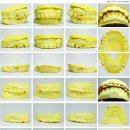 바른치과기공소 이미지