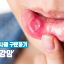 예스안치과의원 네이버블로그