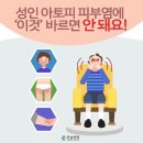 성인 아토피 피부염에 ‘이것’ 바르면 안 돼요!﻿ 이미지