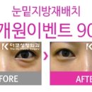 더코성형외과 이미지