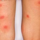 편한의원 이미지