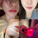 명품에스테틱 | 이수 피부관리 추천 명품에스테틱 이수점 산소테라피 후기
