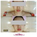 미소체형관리 네이버블로그